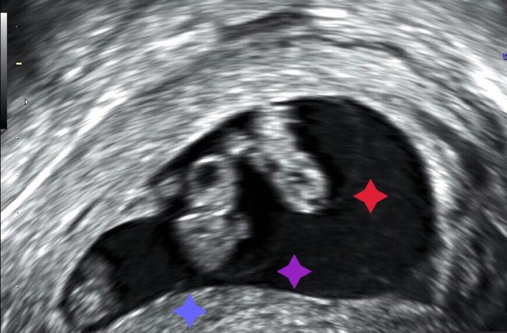 19030374_1738388156454071_3040151231593194129_n