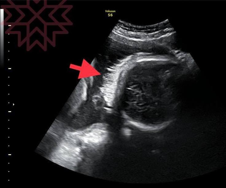 67351924_2143224515970431_4809435083058446336_n