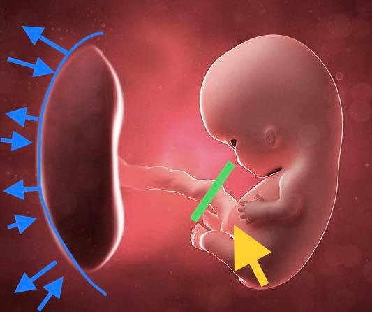 67791144_2155183578107858_5624147188918517760_n